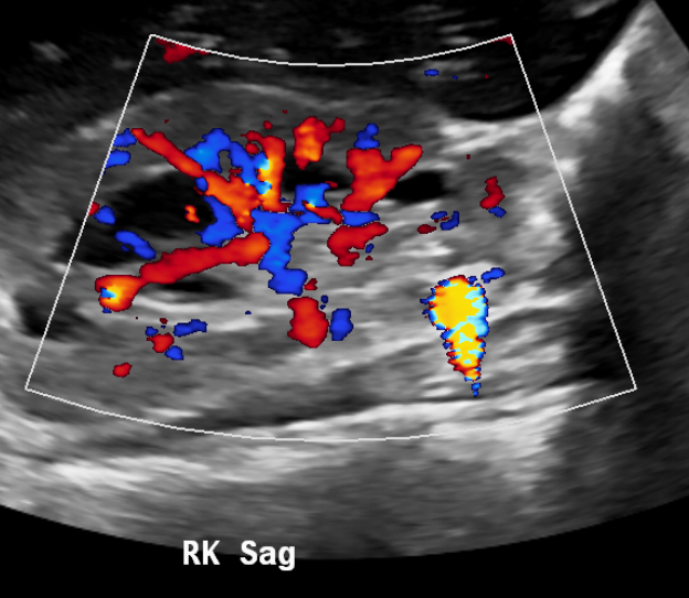 Figure 14