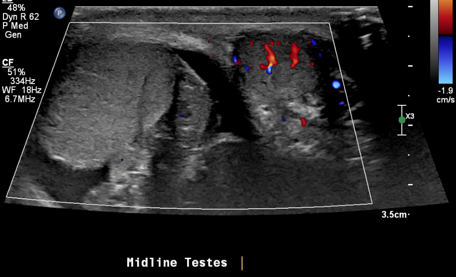 Figure 21