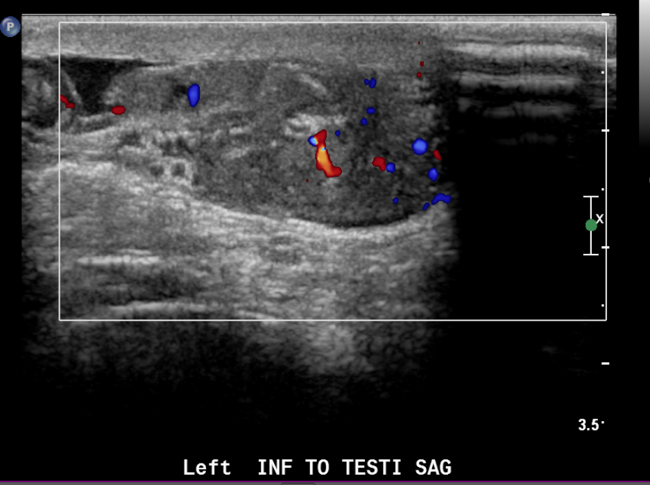 Figure 23