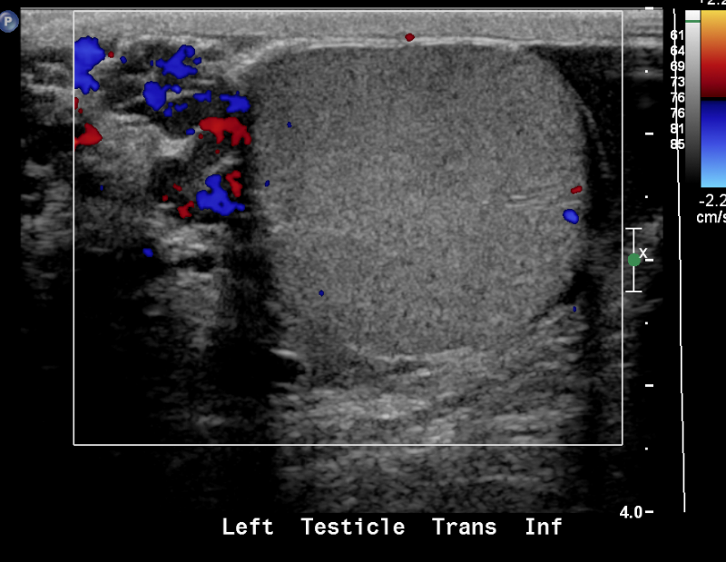 Figure 24