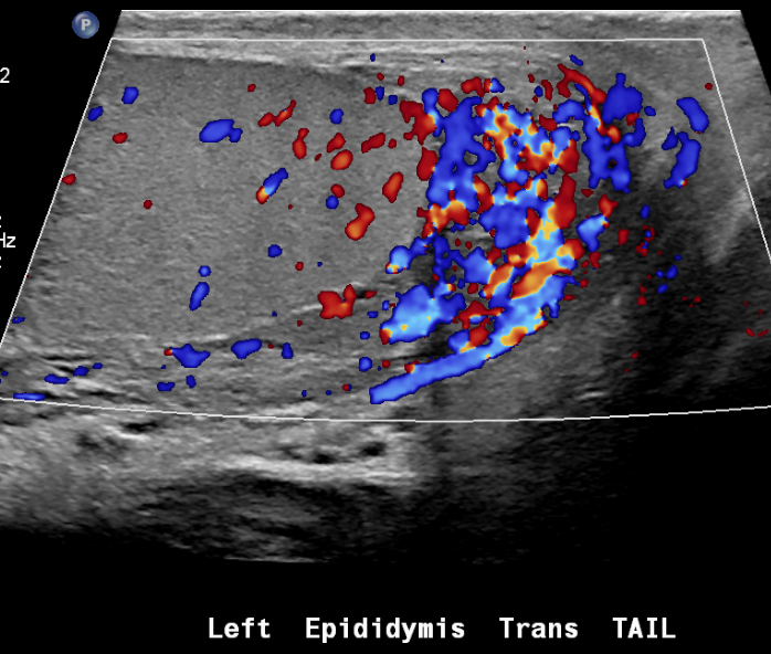 Figure 25