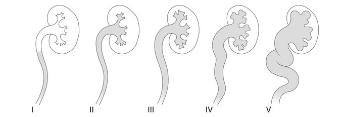 Figure 27