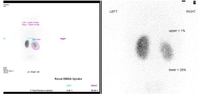 Figure 32