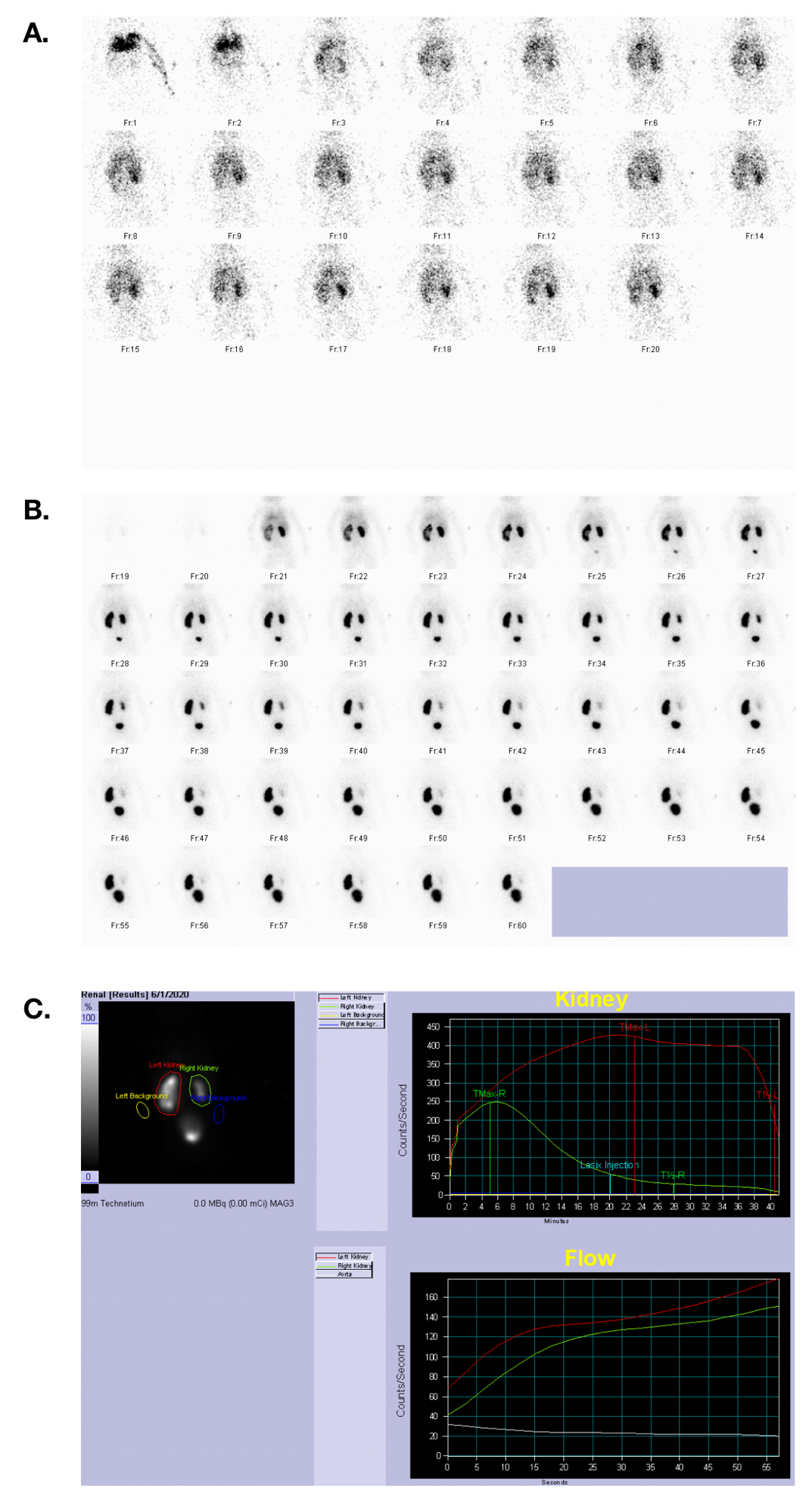 Figure 33