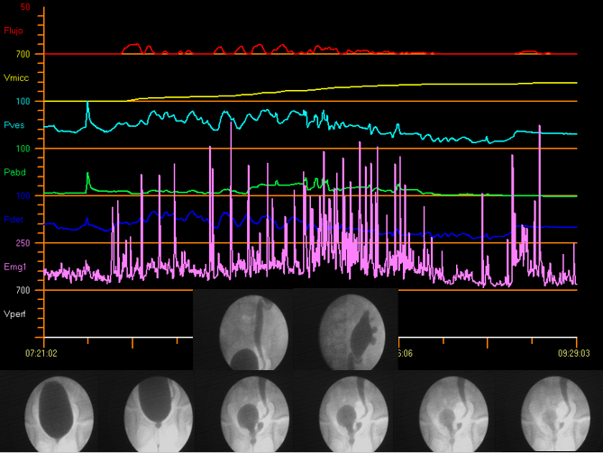 Figure 12