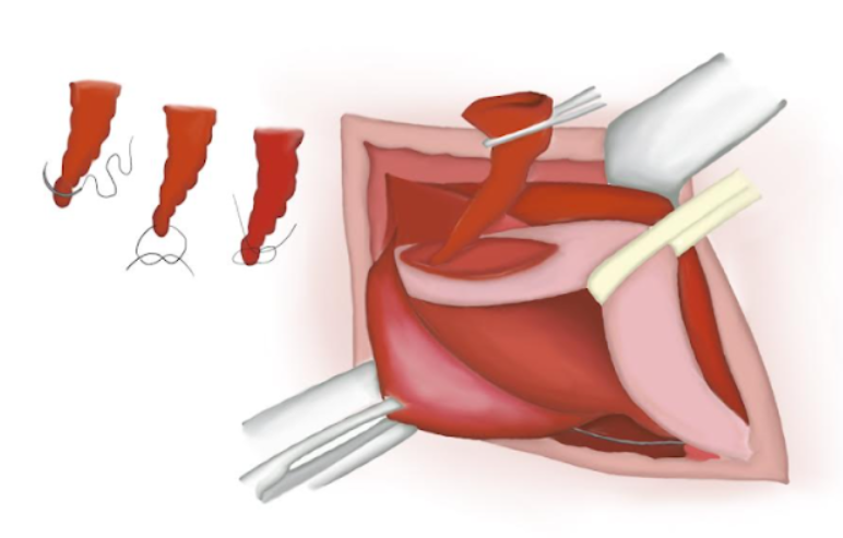 Figure 14