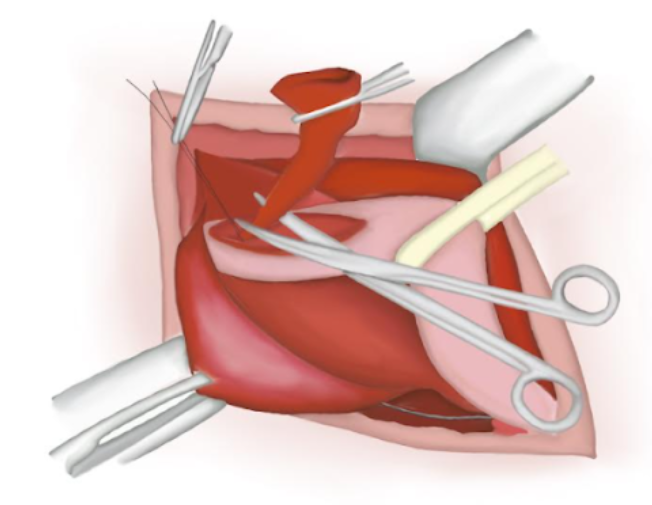 Figure 15