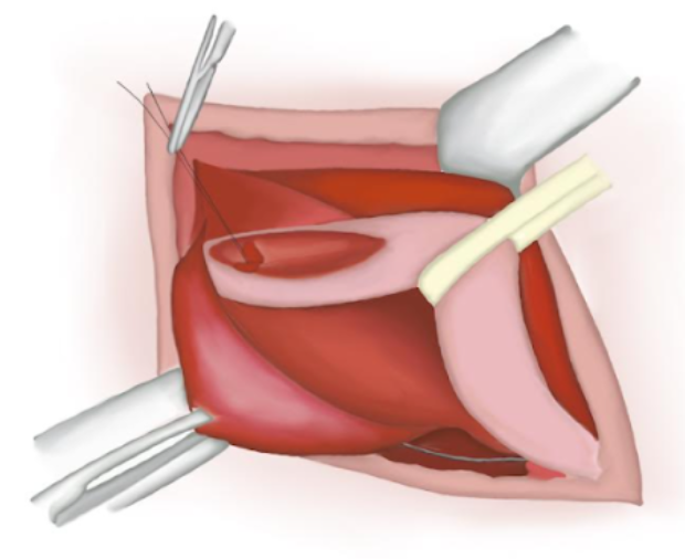 Figure 16